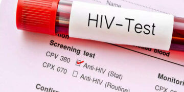 Islamabad registers startling 519 new HIV cases in first ten months