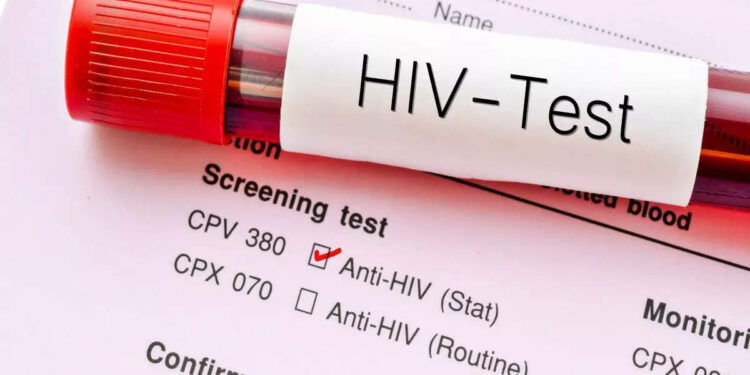 Islamabad registers startling 519 new HIV cases in first ten months