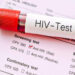 Islamabad registers startling 519 new HIV cases in first ten months